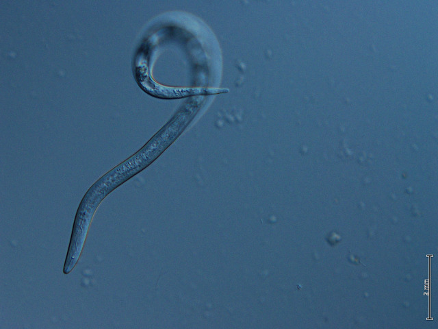 Imagen microscópica de un nemátodo, mostrando su cuerpo alargado y translúcido con una leve curvatura. El fondo azul resalta los detalles internos del organismo, caracterÃ­stico de estos pequeños gusanos que habitan en el suelo y pueden ser fitoparásitos o beneficiosos para las plantas.