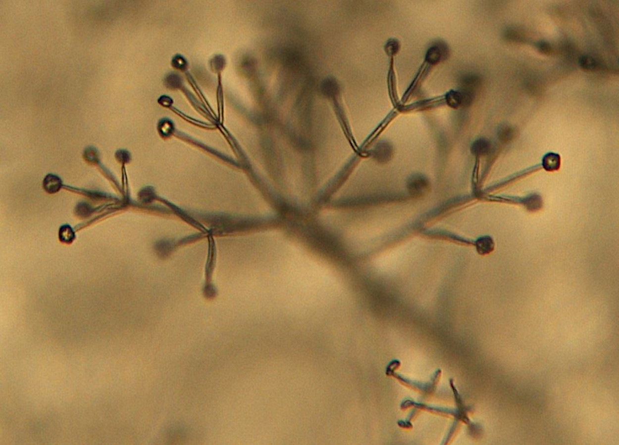 Estructura microscópica de un hongo del género Verticillium, mostrando hifas y conidióforos con conidios.